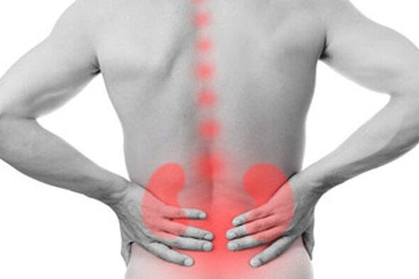 Patologiile renale pot provoca apariția durerilor de spate