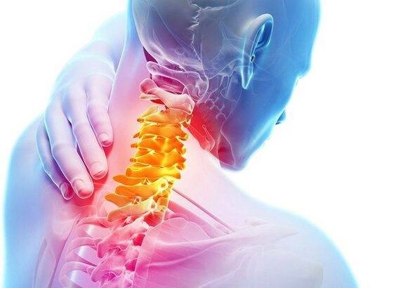 osteochondroză