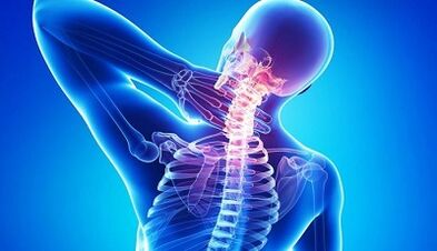 Simptomele și tratamentul osteochondrozei cervicale
