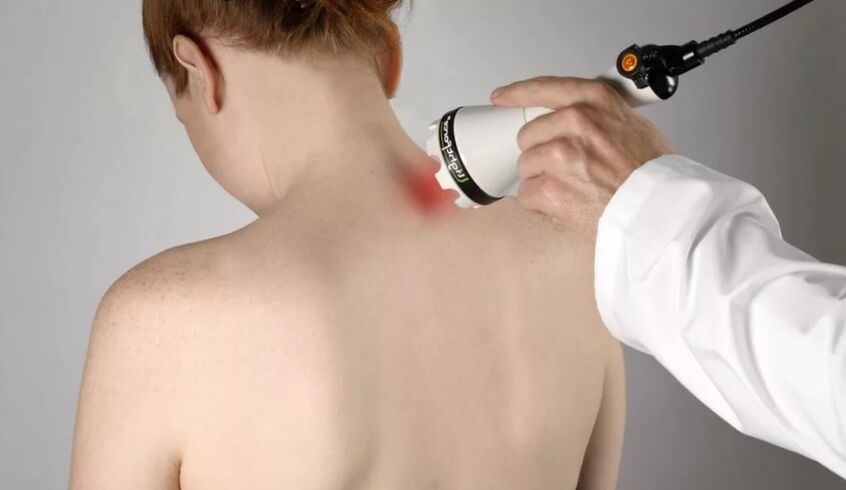Metoda fizioterapeutică de tratare a osteocondrozei cervicale